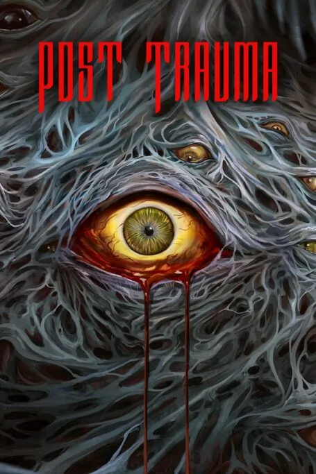Post-Trauma